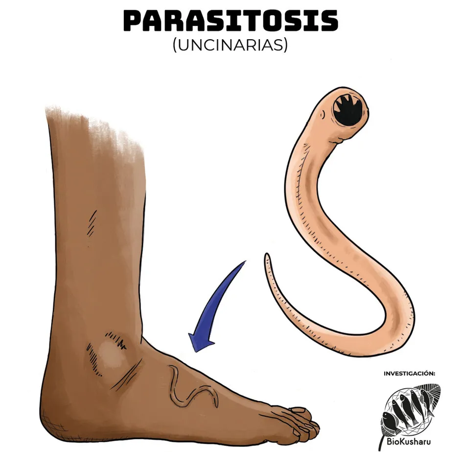 Ficha: Parasitosis
